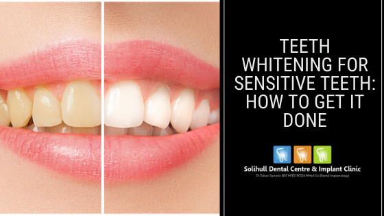Teeth Whitening For Sensitive Teeth: How to Get it Done